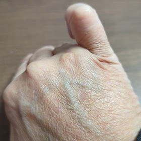 指の伸ばしについての画像