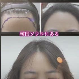 当院だけの手術方式！最新の医術で安心！の画像