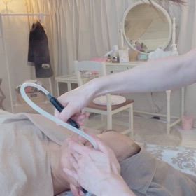 口下のザラつきがなくなっていた！の画像