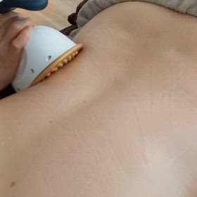 ラジオ波の効果最高！の画像