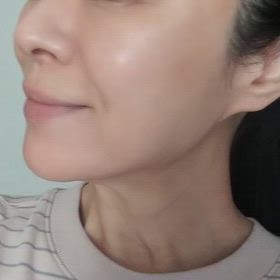 水光注射のダウンタイム５日目の朝の動画の画像