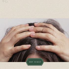 乾性頭皮管理の画像