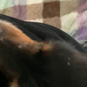 痙攣発作の画像