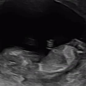 11w2d happy new year with a good news!の画像