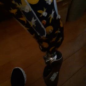 義足のアライメント不良で腰と股関節を痛めるの画像