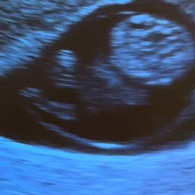 【2人目妊娠記録】9w3d 不妊治療クリニック卒業の画像