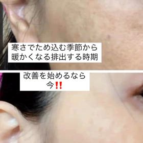 改善始めるなら今！の画像