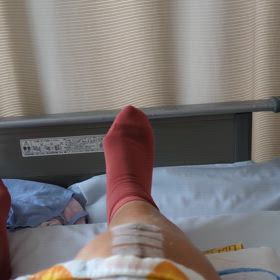 人工膝関節置換術～②入院15日目の画像