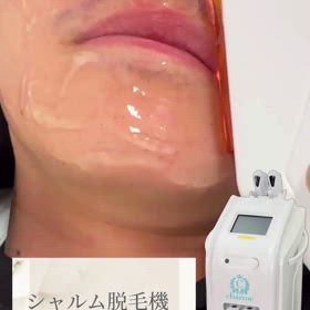 業務用脱毛機の画像