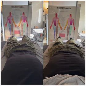 新規のALSの方　北の大地からの画像