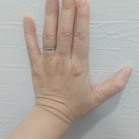 上位運動ニューロン障害の画像