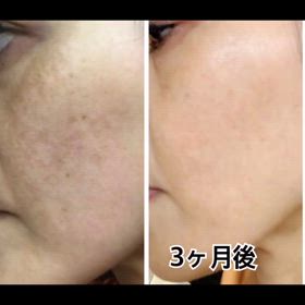 数量限定！はだのへんかの画像