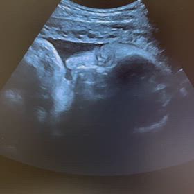 ついに産休！最後の健診でついにあれが見れましたの画像