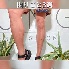 剛毛の困りごとは脱毛で解決❗の画像