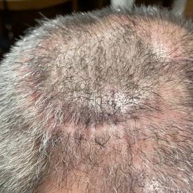 旦那の手術の画像