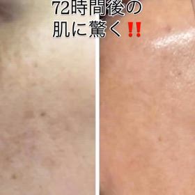 72時間後肌が変わるトリートメントの画像