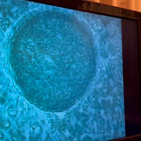 衝撃！？ソマチッドが塊になる瞬間動画です！！の画像