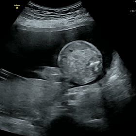 21w2d  性別判明❗️の画像