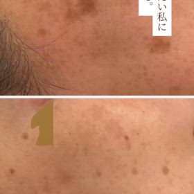 本気の肌改善の画像