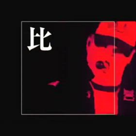 シュントの画像