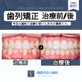 韓国今日の歯科の治療事例映像の画像