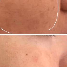 肌を押し上げる力の画像