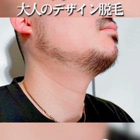 脱・青ひげ！大人のデザイン脱毛✨の画像