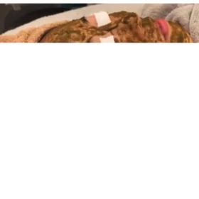 冬はお肌再生のチャンス✨の画像