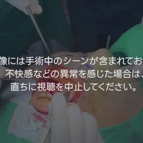 フル切開リフト✎の画像