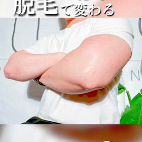 男の汗臭さ　脱毛で変わる✨の画像