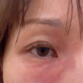 効果を感じなかった美容施術　の画像