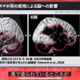 思春期のインターネットの不適切使用が精神病症状や抑うつリスクを高めるの画像
