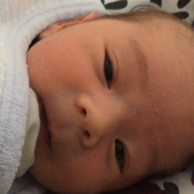 生後10日の画像