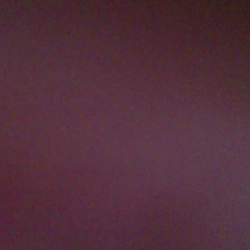 今回の症状(前庭疾患再発)の画像