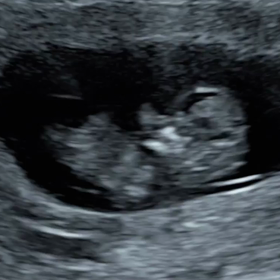 血液検査の画像