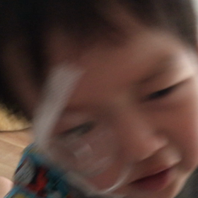 気管切開後の発声の画像