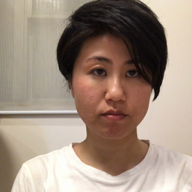 セルライト 太もも+ヒップ Y様｜心月整体院・奈良施術院・女性専用サロンの画像