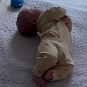 3m10d 乳腺炎の画像