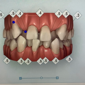 矯正が増えてますの画像