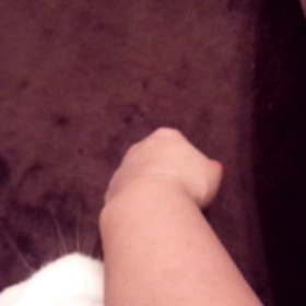 痛くても、嬉しいですの画像