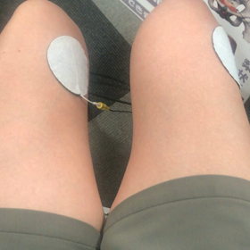 高周波EMSの画像