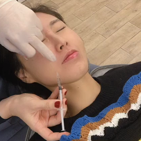 ♡ハリ・ツヤ、リフティング効果も！ペッパン注射について♡の画像