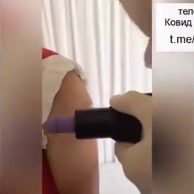 接種後30分以内での画像