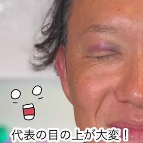 【アザをメイクでカバーする】の画像