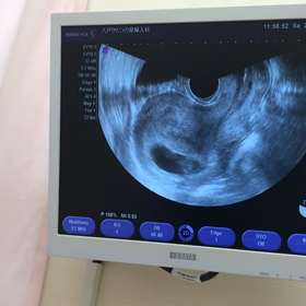 10w.妊婦健診 *.ﾐﾐ エコー動画 ♡の画像