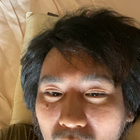 かさかさの画像