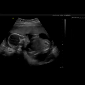 第二子妊娠記録～7ヶ月～の画像