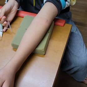 最近のこと(針や注射、血液が苦手な人は見ないでください:画像あり)の画像