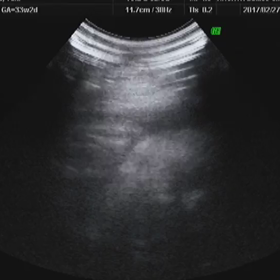 【妊婦徒然日記】33w2d  エコーでまばたきパチパチ♡の画像