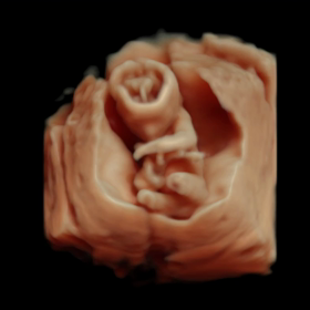 妊娠5ヵ月の画像